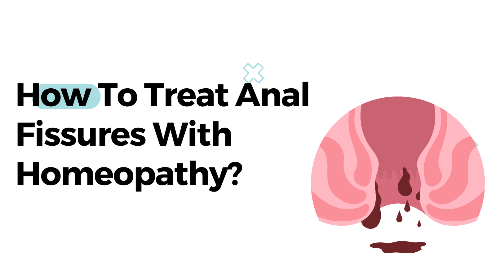How To Treat Anal Fissures With Homeopathy?