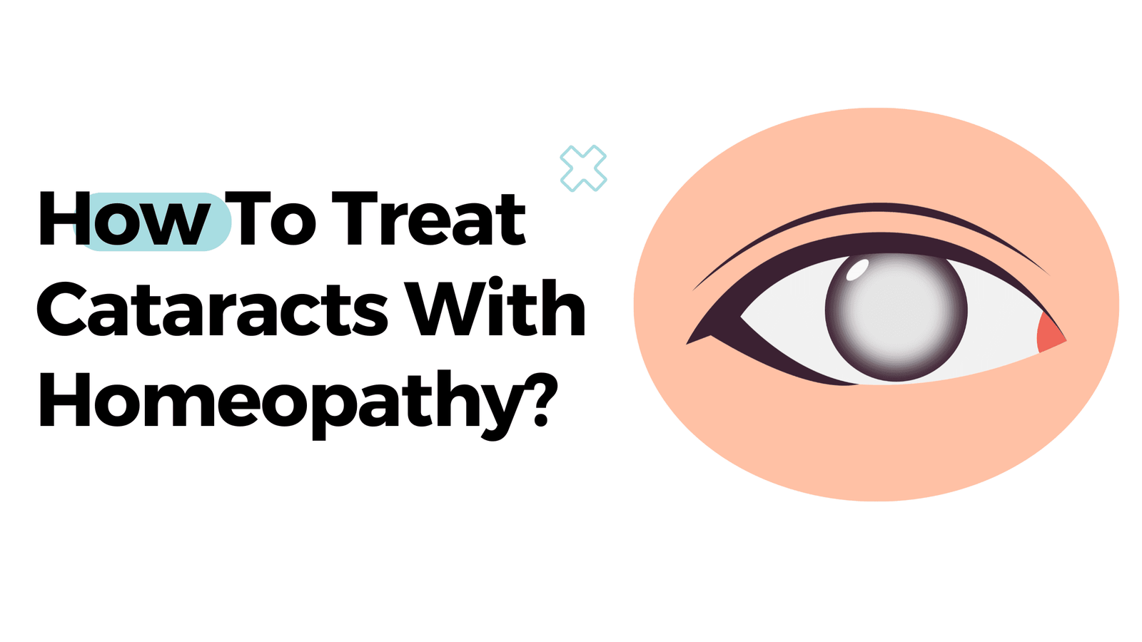 How To Treat Cataracts With Homeopathy?