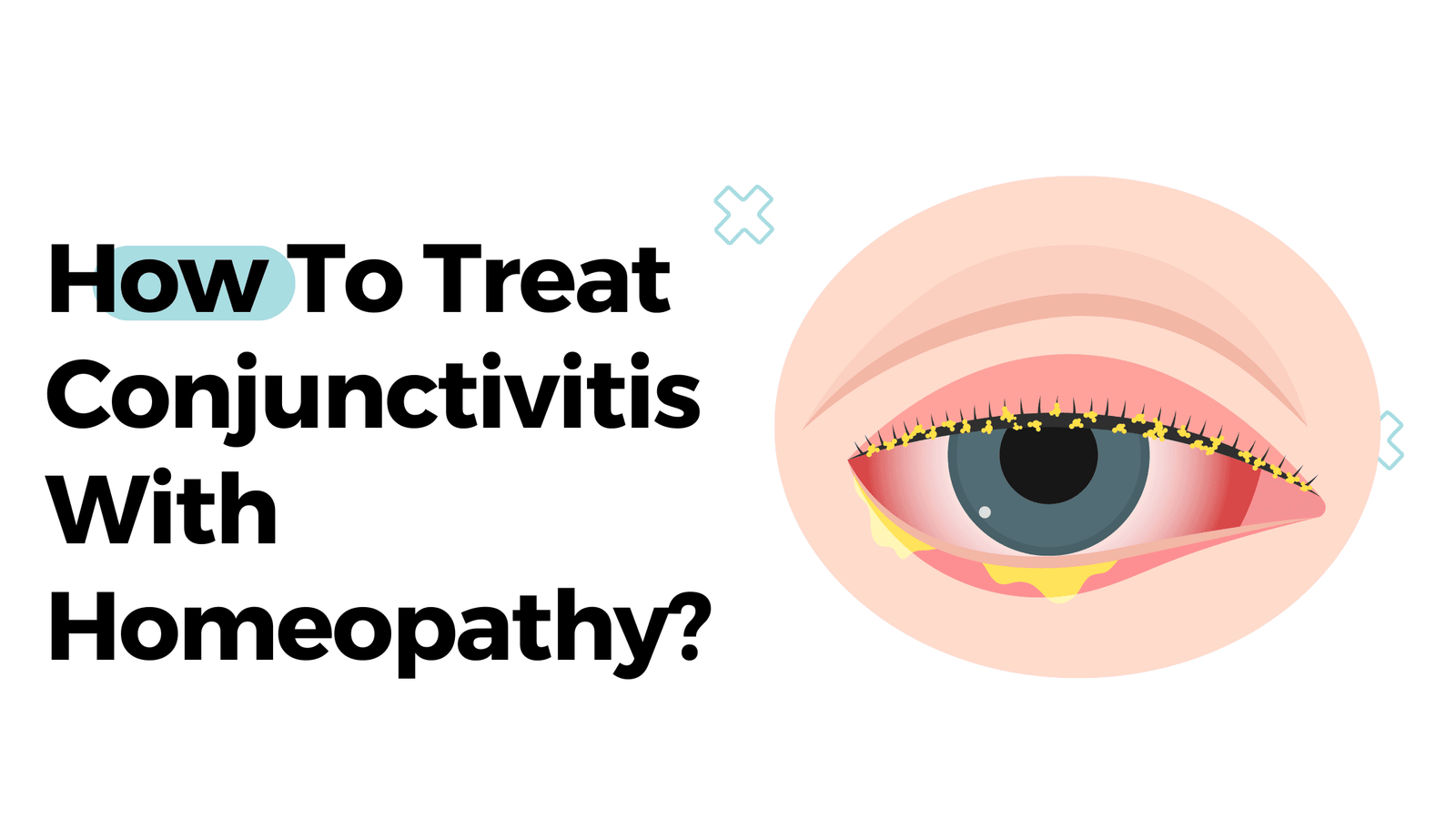 How To Treat Conjunctivitis With Homeopathy?