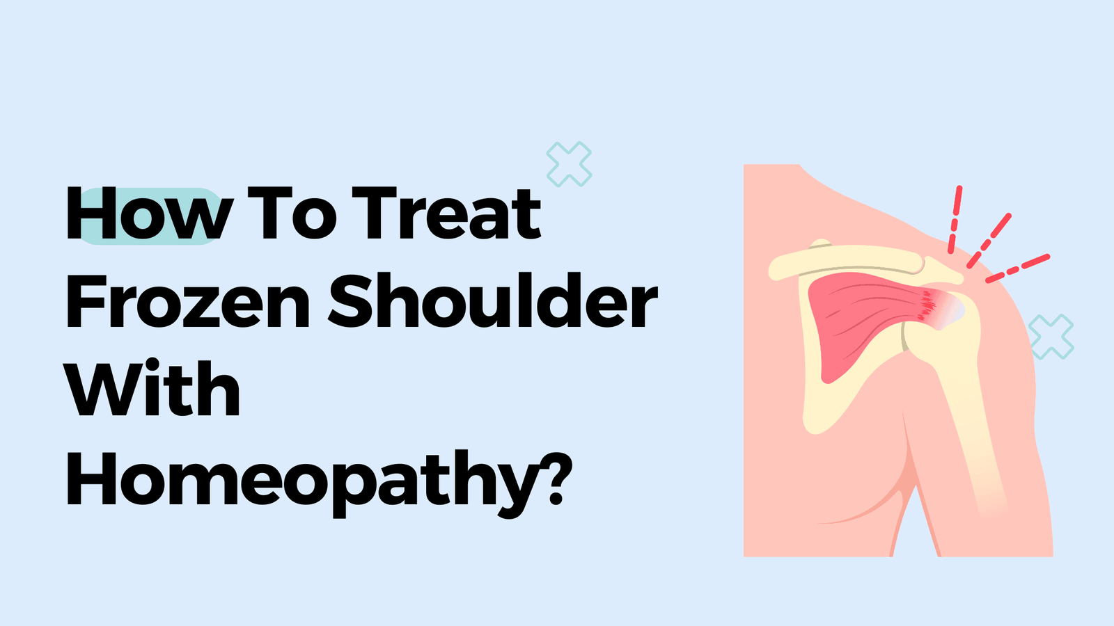 How To Treat Frozen Shoulder With Homeopathy?