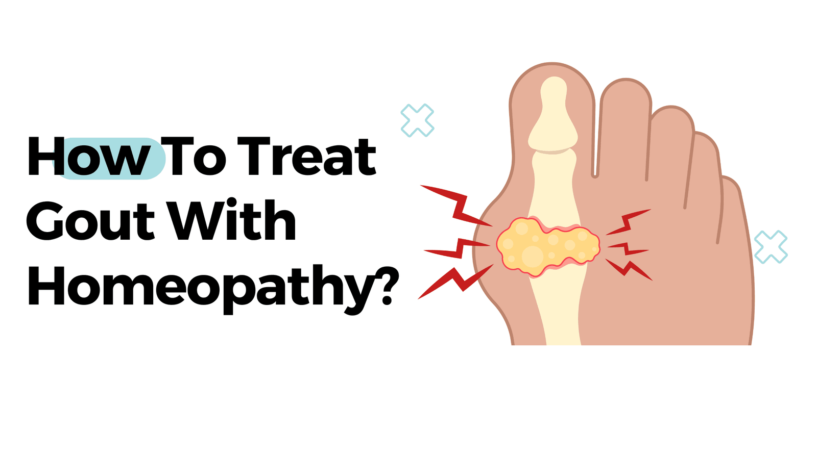 How To Treat Gout With Homeopathy?