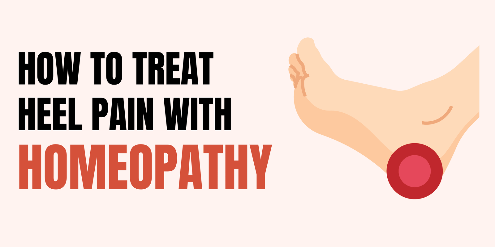 How To Treat Heel Pain With Homeopathy?