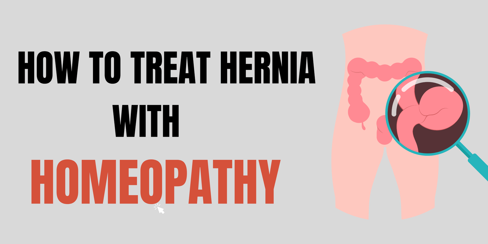 How To Treat Hernia with Homeopathy?