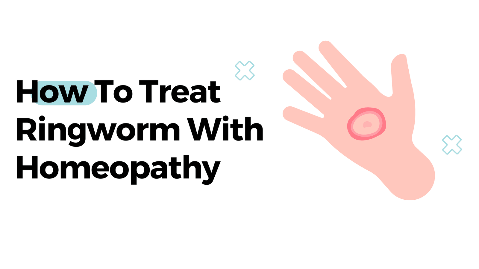 How To Treat Ringworm With Homeopathy?