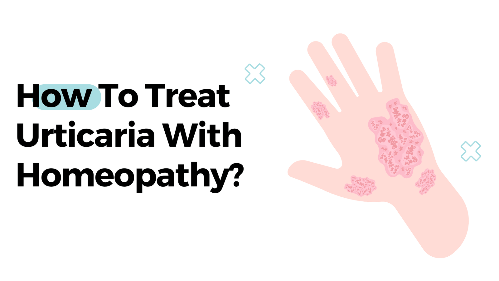 How To Treat Urticaria With Homeopathy?
