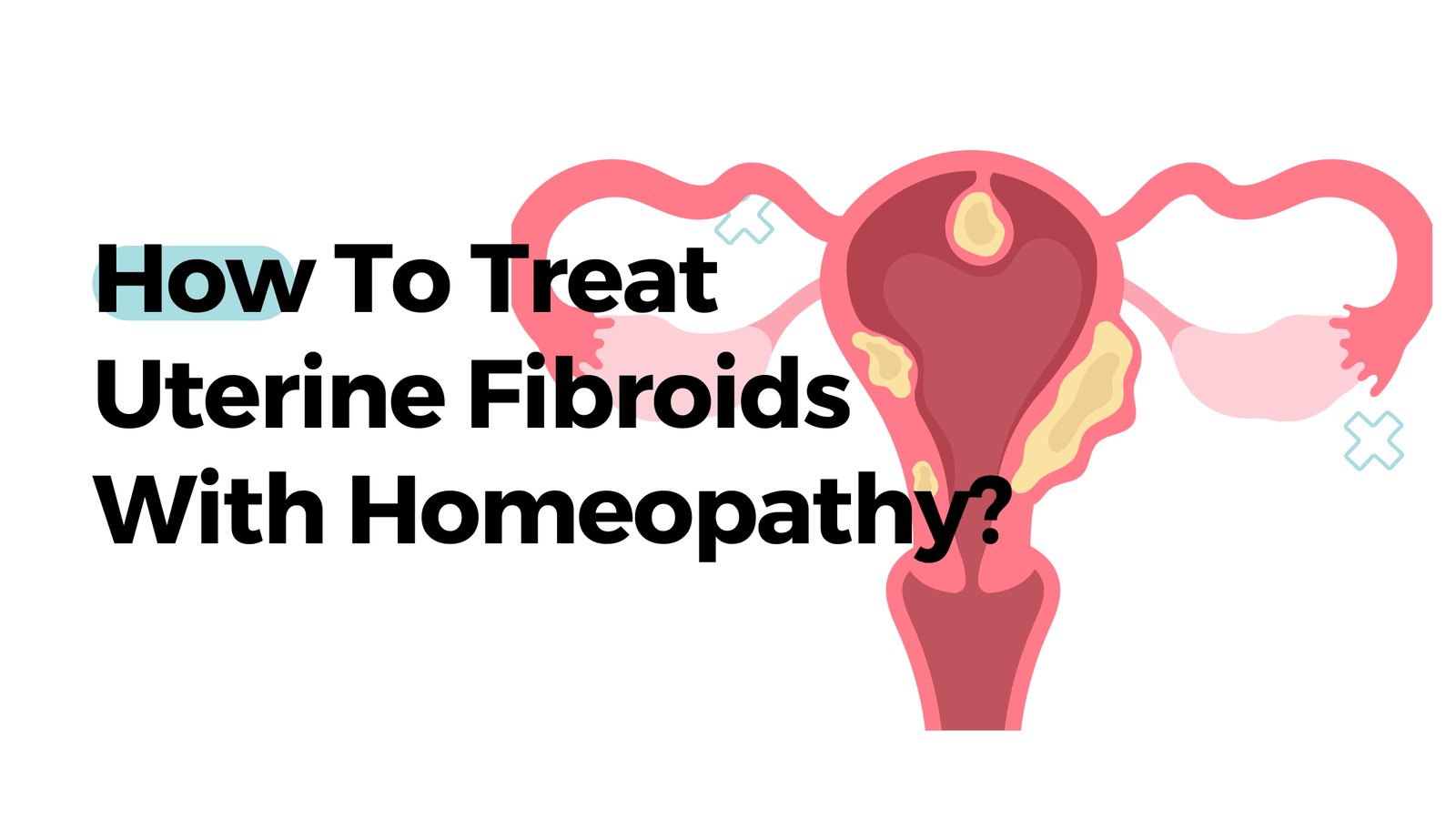 How To Treat Uterine Fibroids With Homeopathy?