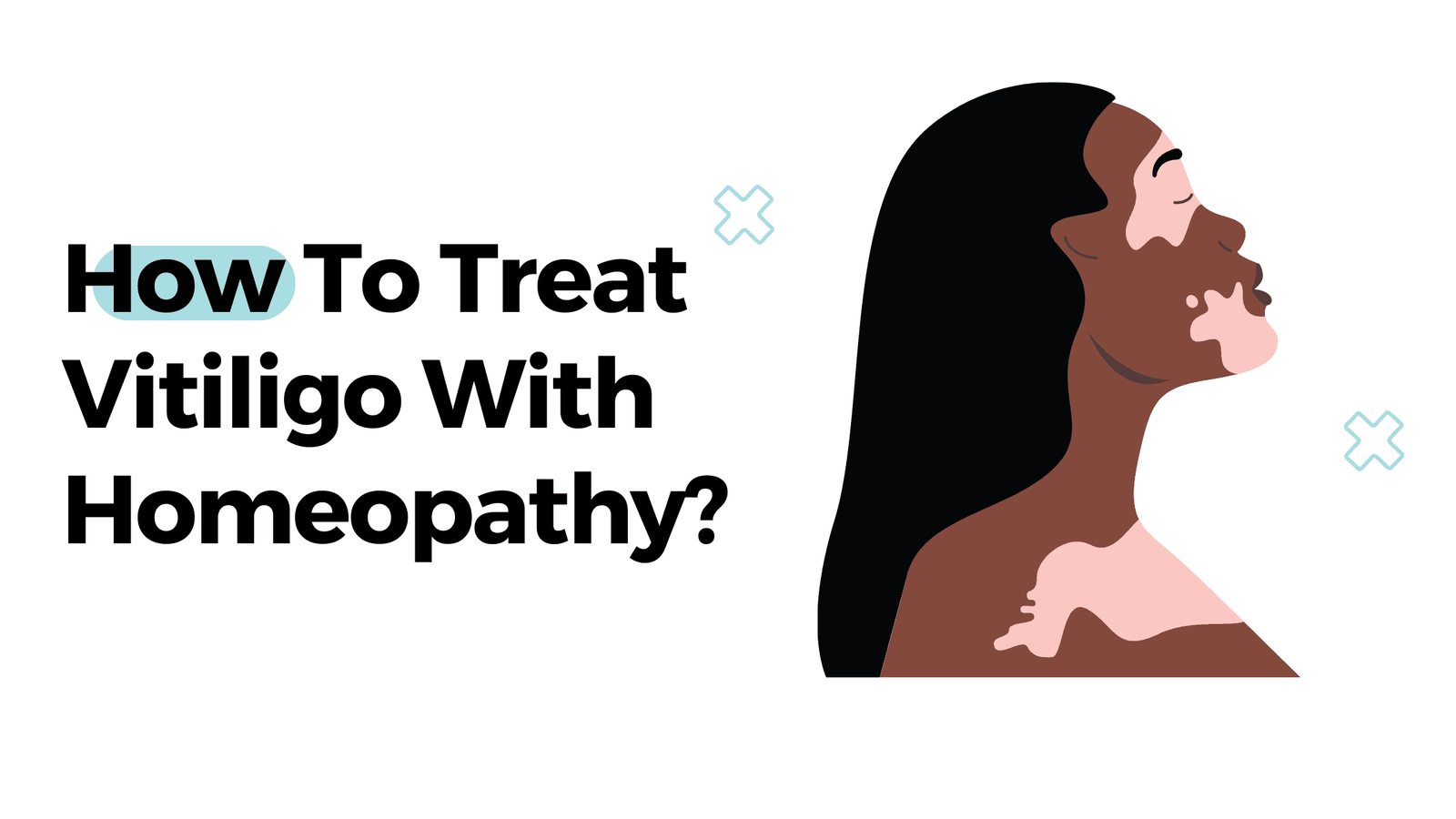 How To Treat Vitiligo With Homeopathy?