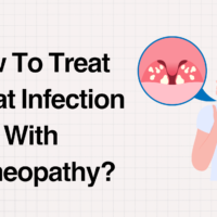 How To Treat Throat Infection With Homeopathy?