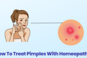 How To Treat Pimples With Homeopathy?