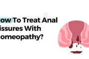 How To Treat Anal Fissures With Homeopathy?