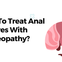 How To Treat Anal Fissures With Homeopathy?