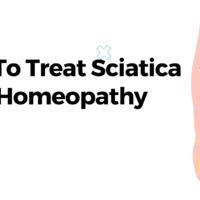 How To Treat Sciatica With Homeopathy?
