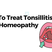 How To Treat Tonsillitis With Homeopathy?