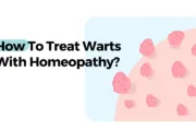 How To Treat Warts With Homeopathy? How To Treat Warts With Homeopathy?