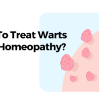 How To Treat Warts With Homeopathy?