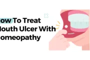 How To Treat Mouth Ulcers With Homeopathy? How To Treat Mouth Ulcers With Homeopathy?