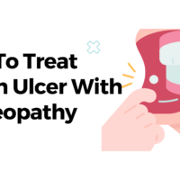 How To Treat Mouth Ulcers With Homeopathy?