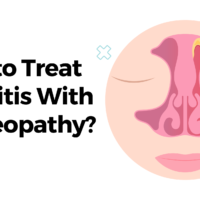 How to Treat Sinusitis With Homeopathy?