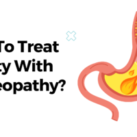 How To Treat Acidity With Homeopathy?