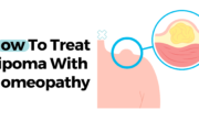 How To Treat Lipoma With Homeopathy?