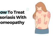 How To Treat Psoriasis With Homeopathy?