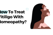 How To Treat Vitiligo With Homeopathy?
