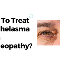 How To Treat Xanthelasma With Homeopathy?