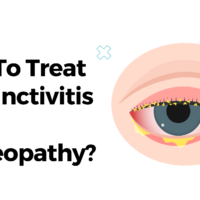 How To Treat Conjunctivitis With Homeopathy?