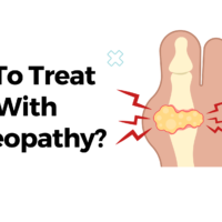 How To Treat Gout With Homeopathy?