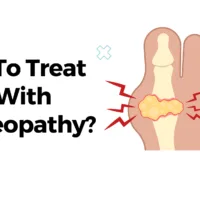 How To Treat Gout With Homeopathy?