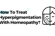How To Treat Hyperpigmentation With Homeopathy?