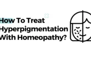 How To Treat Hyperpigmentation With Homeopathy?