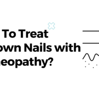 How To Treat Ingrown Nails with Homeopathy?