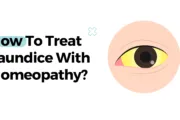 How To Treat Jaundice With Homeopathy?