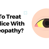 How To Treat Jaundice With Homeopathy?