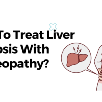 How To Treat Liver Cirrhosis With Homeopathy?