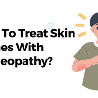 How To Treat Skin Rashes With Homeopathy?