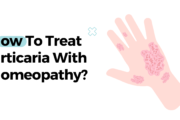 How To Treat Urticaria With Homeopathy?