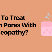 How To Treat Open Pores With Homeopathy?